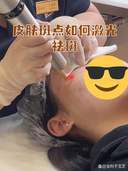 梅州激光祛晒斑推荐:2026年正规医院价格表与避坑指南
