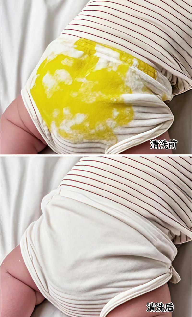 2026榆林本地婴儿衣物清洗服务全解析:正规服务商推荐与价格