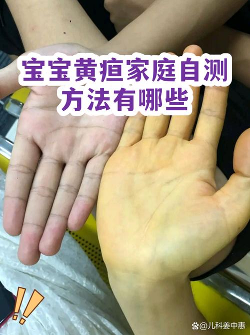 苏州本地新生儿黄疸观察费用参考:2026年正规育儿嫂服务价格