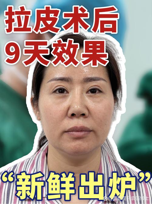2026商丘吸脂填充哪家强？公立三甲与专业机构对比及价格指南