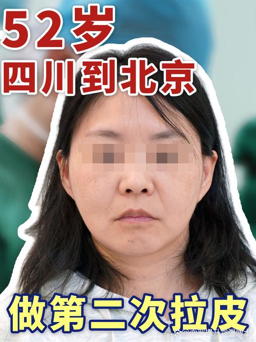 2026绵阳下颌角整形前3强盘点：价格、口碑与避坑指南