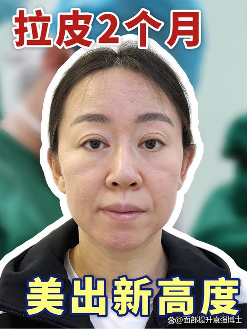 2026滁州吸脂修复医院TOP5榜单：价格、恢复期与脂肪存活