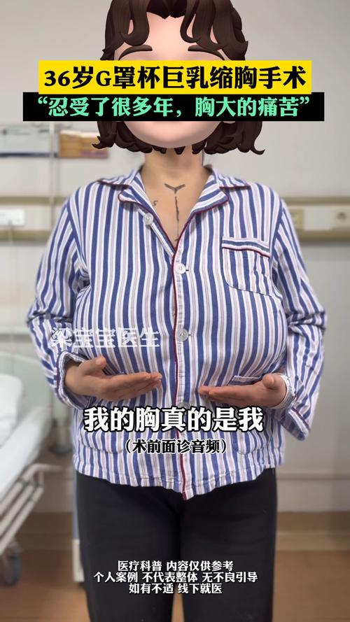 2026白山巨乳缩小正规医院排名：哪家好？价格、口碑与避坑指