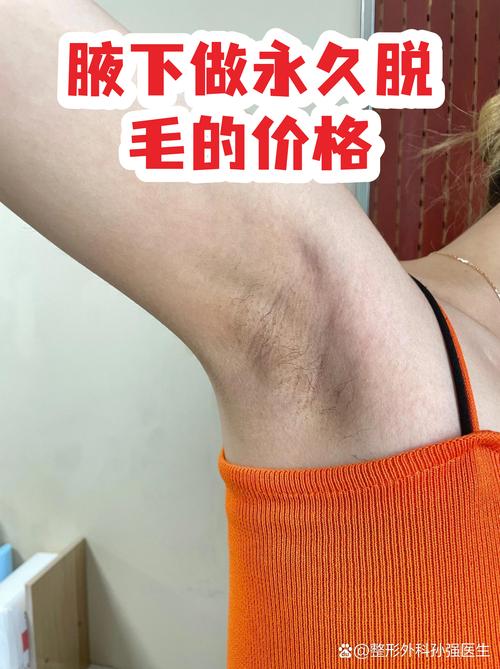 2026定西腋下脱毛前3强推荐：哪家正规？价格多少？深度避坑
