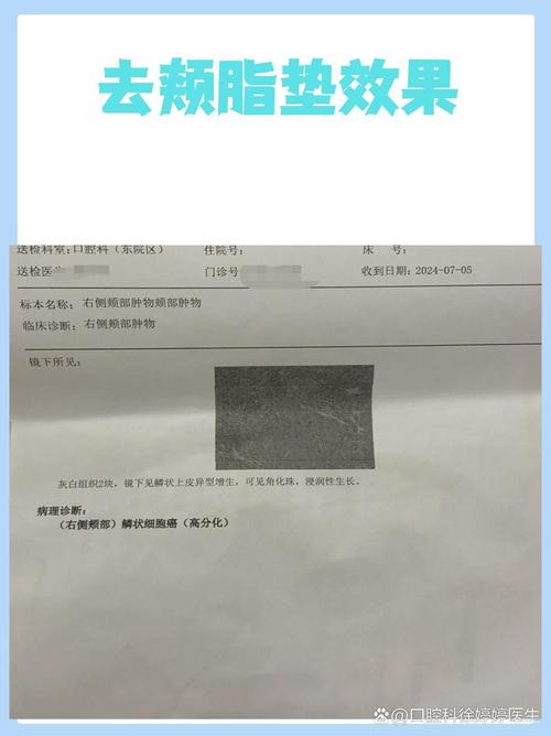 晋城颊脂垫去除2026年行业盘点:正规机构选择指南与价格参考