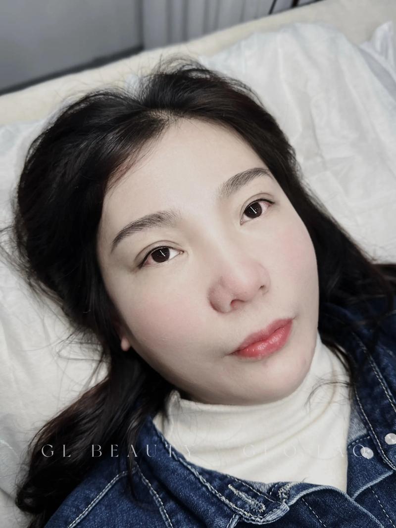 抚州美瞳线推荐2026:正规前十强机构、价格表及专业避坑指南