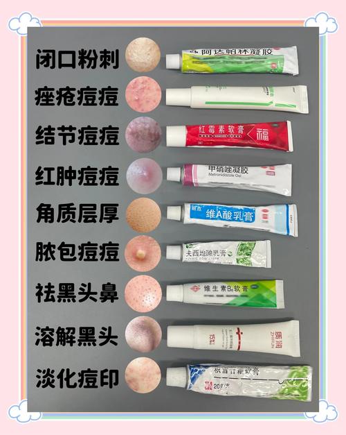 林芝痘肌治疗推荐清单2026：正规医院价格及避坑指南