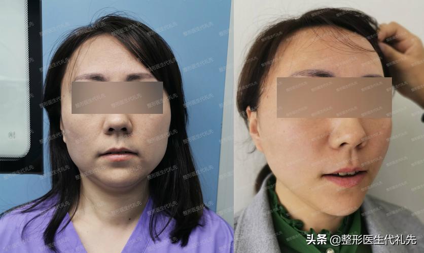 2026年珠海下颌缘提升注射推荐清单:正规机构、口碑与避坑指