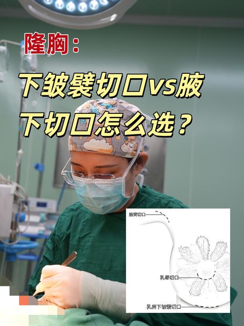 2026内江假体隆胸怎么选?正规医院、价格费用与避坑指南