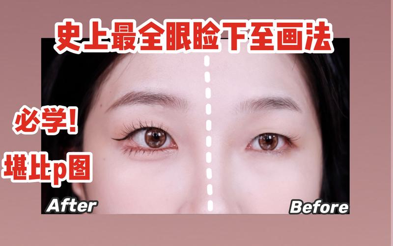 哈尔滨下眼睑下至避坑指南：正规医院怎么选？价格与风险全解析