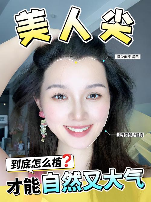 乌鲁木齐美人尖种植哪家好?2026年正规医院推荐与价格避坑指