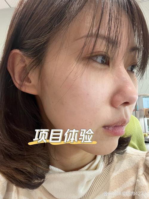 榆林基础水光专业推荐:2026年价格、口碑及怎么选的全面解析